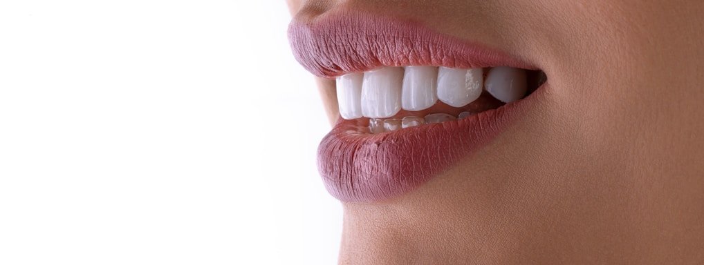 a close up of a woman's mouth with white teeth