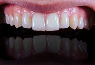 a close up of a person's mouth with a missing tooth