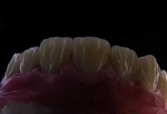 a close up of a tooth with gumpaste on it