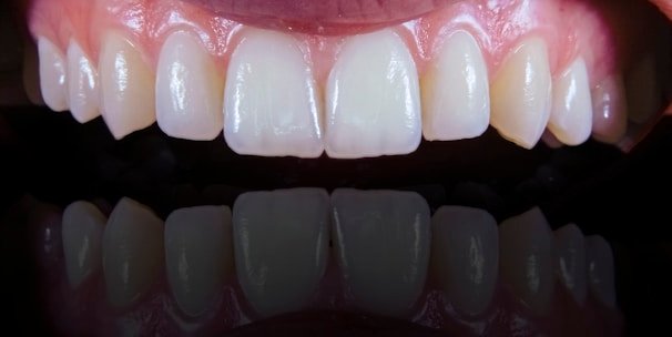 a close up of a person's mouth with a missing tooth