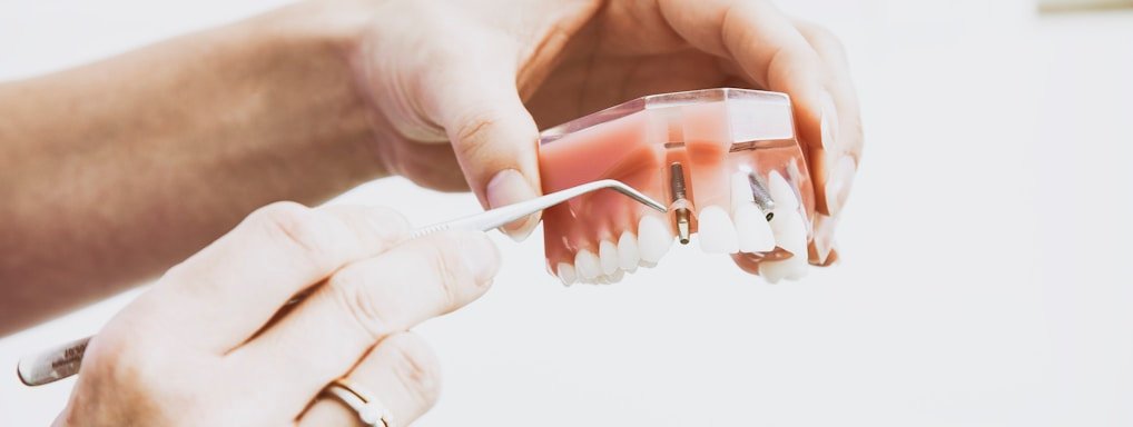 person wearing silver-colored ring while holding denture