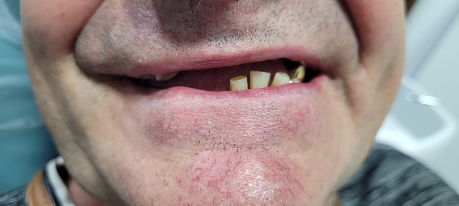 Situația dentară înainte de tratament